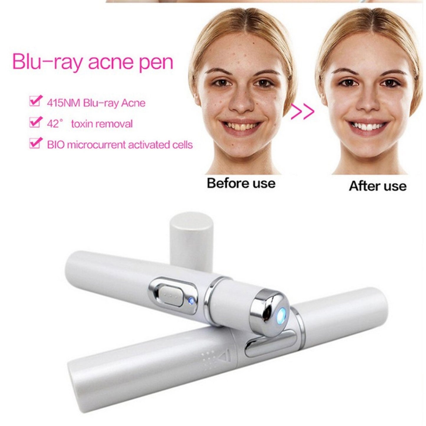 Blue Light Acne Therapy Pen