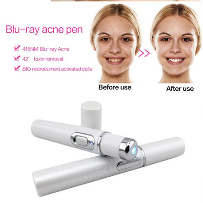 Blue Light Acne Therapy Pen