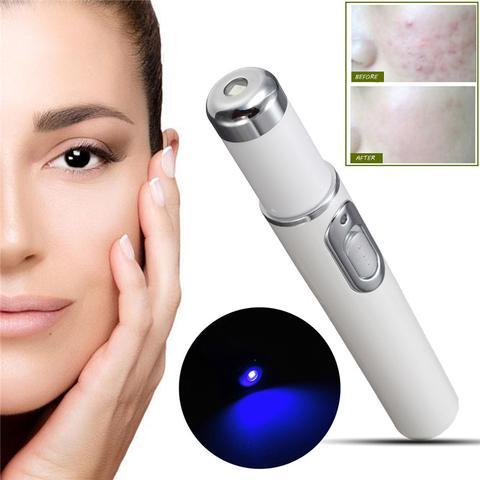 Blue Light Acne Therapy Pen